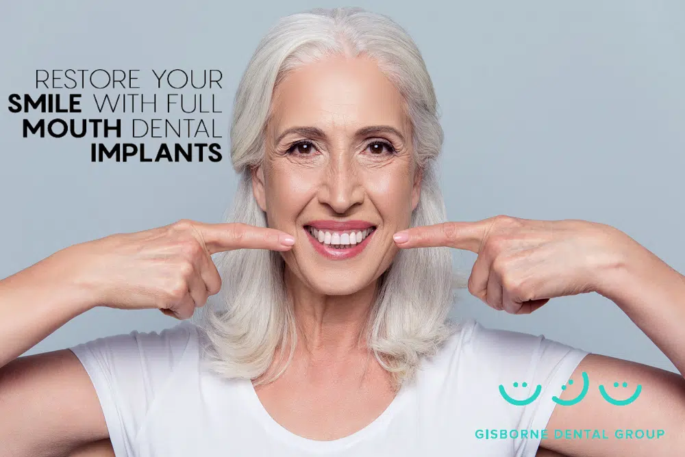 Dental Implants-special