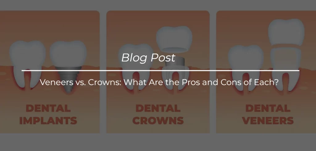 Veneers vs. Crowns_ What Are the Pros and Cons of Each_