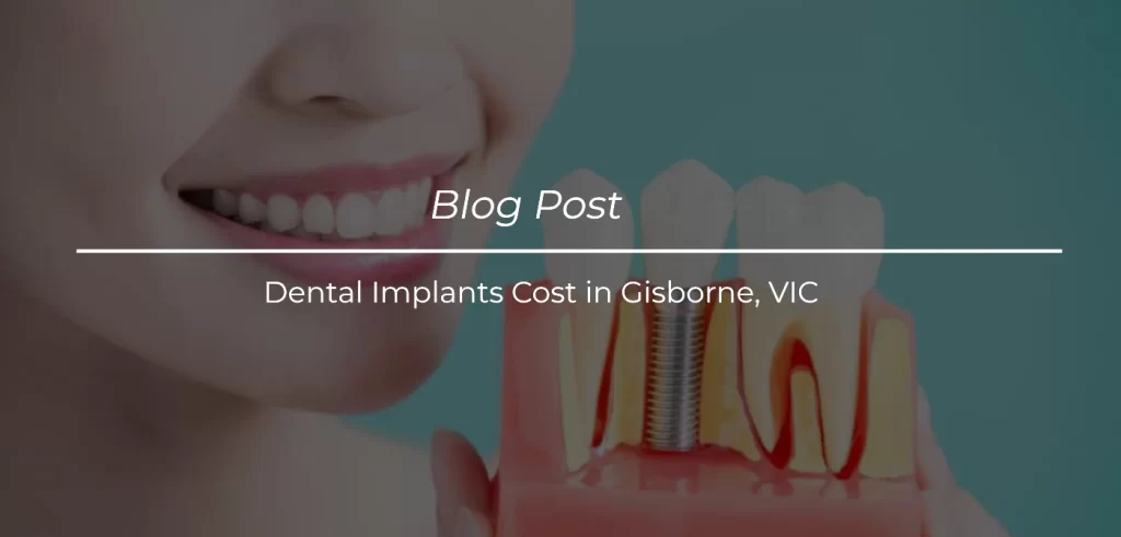 dental-implant-model