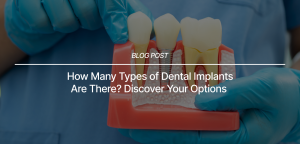 How Many Types of Dental Implants Are There Discover Your Options