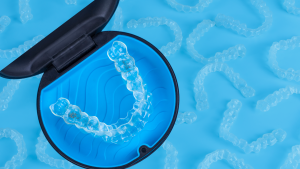 An invisalign aligner